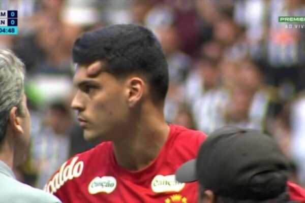 Santos atualiza quadro do goleiro Gabriel Brazão. Veja santos-atualiza-quadro-do-goleiro-gabriel-brazao.-confira